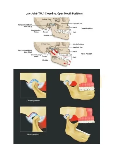 Jaw Joint (TMJ) Positions